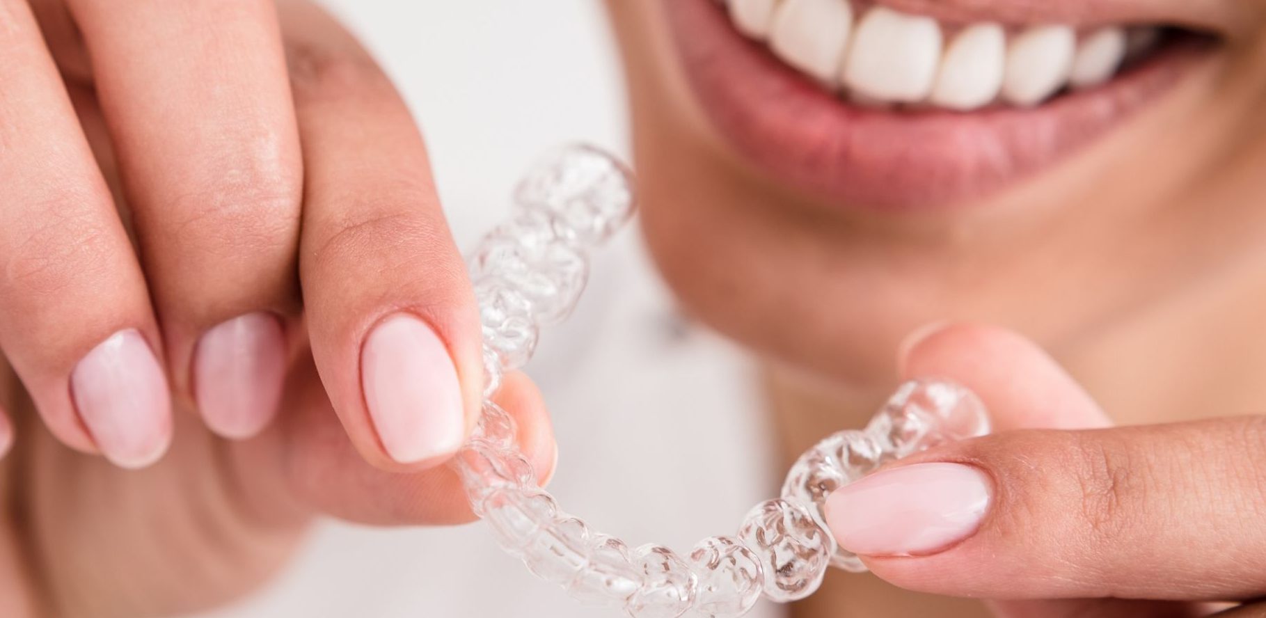 Global Clear Aligners Market