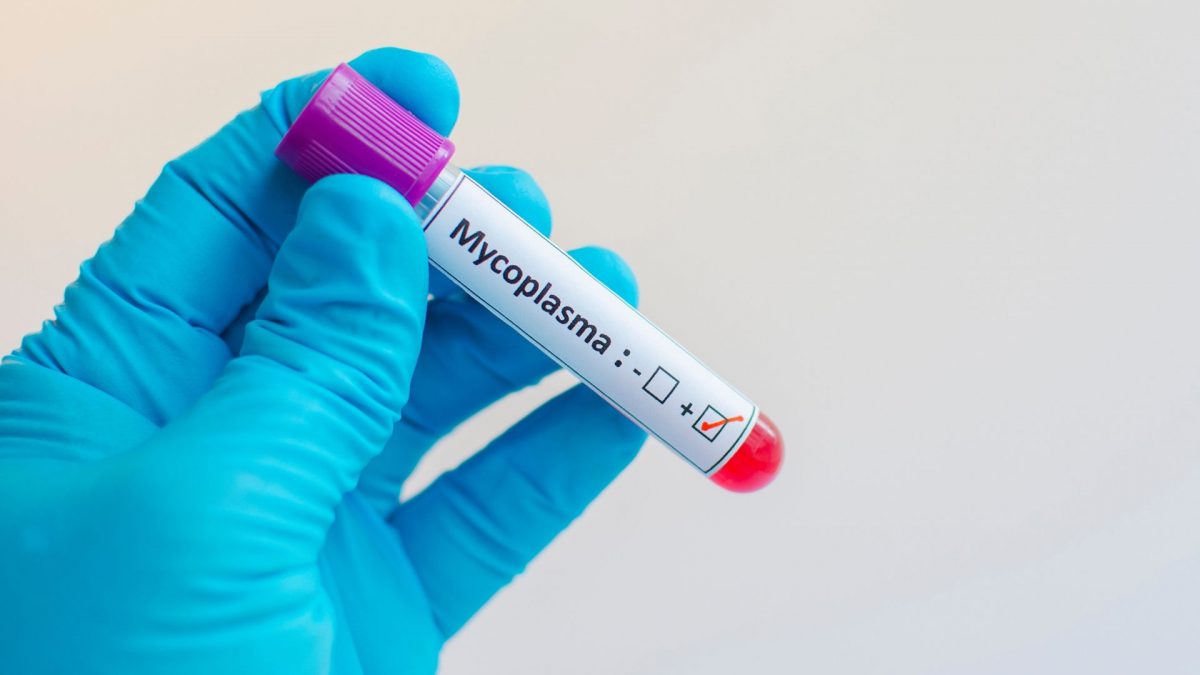 Global Mycoplasma Testing Market Overview And Prospects