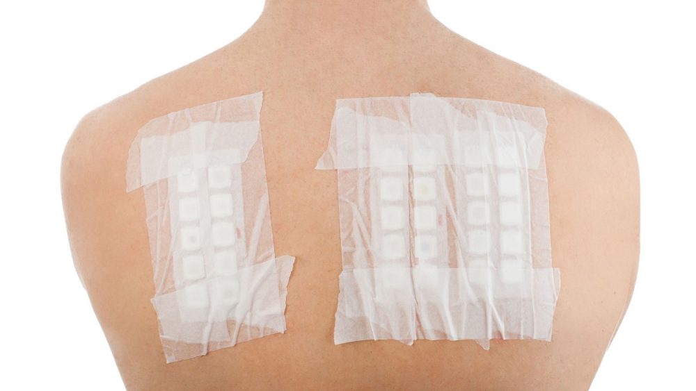 Global Transdermal Skin Patches Market Overview And Prospects