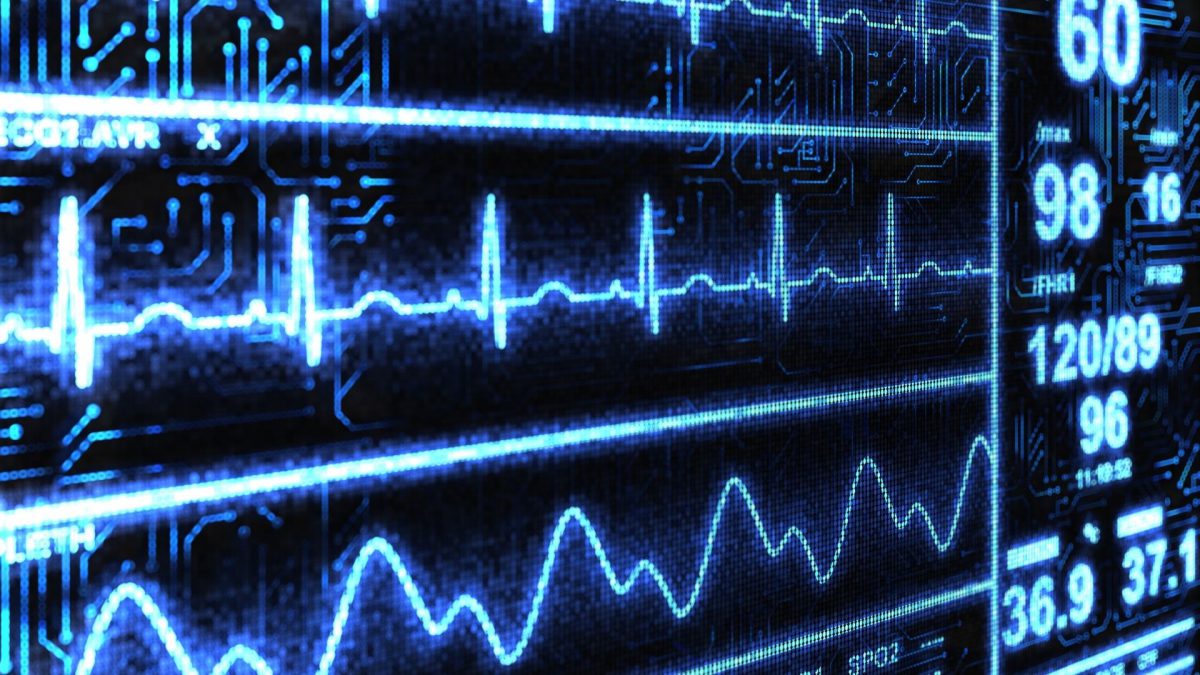 Global Cardiac Rhythm Management (CRM) Devices And Equipment Market Outlook, Opportunities And Strategies