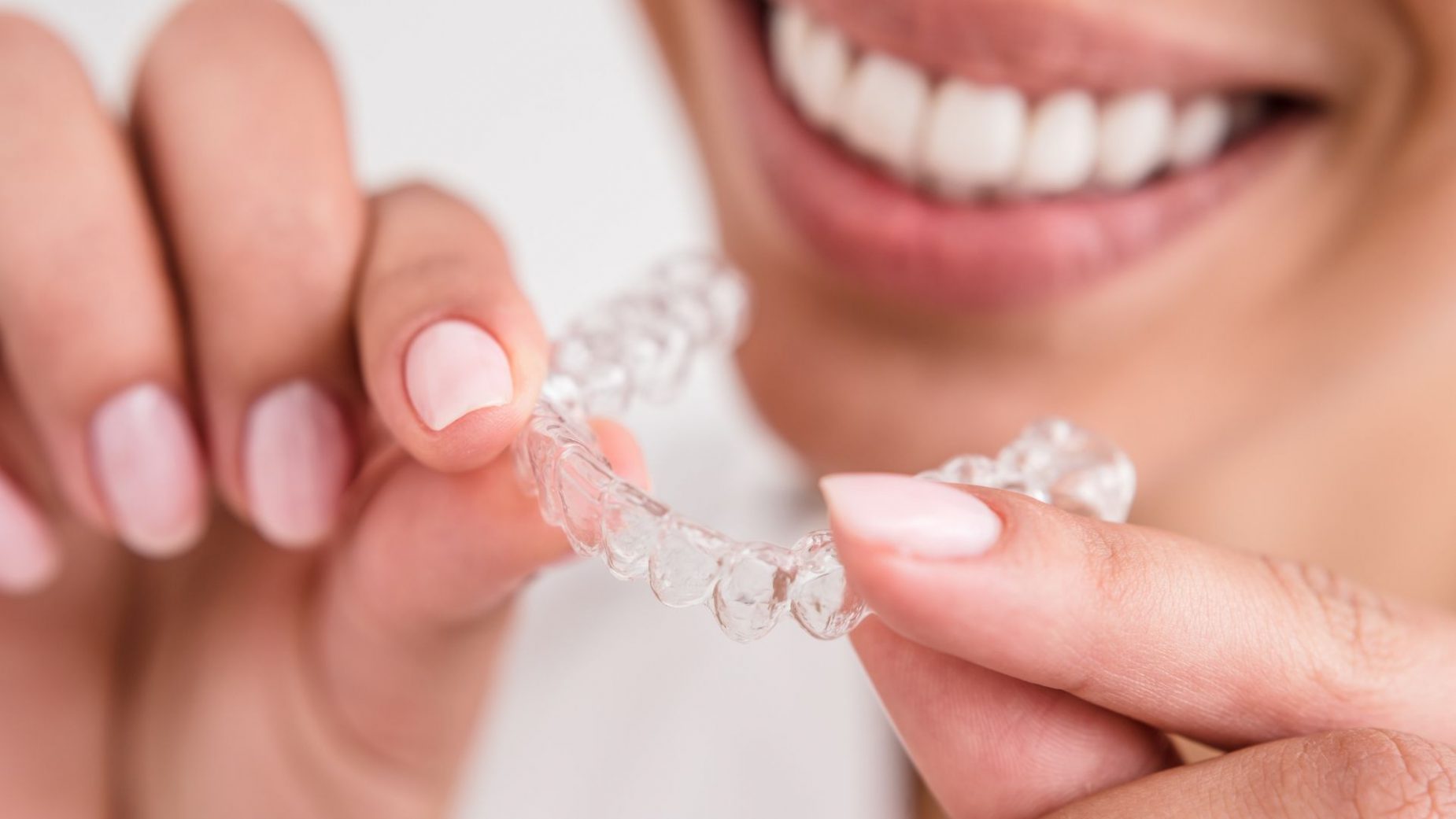 Global Clear Aligners Market Size, Forecasts, And Opportunities