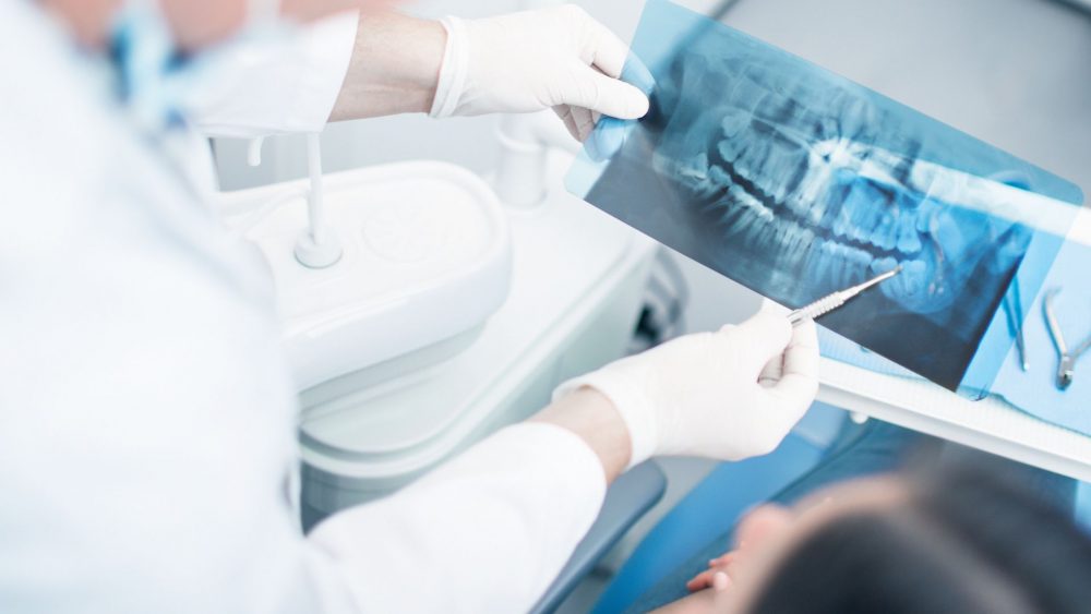 Global Dental X-Ray Equipment Market Overview And Prospects