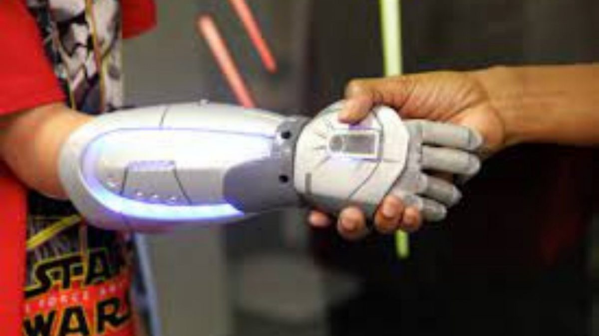 3D printed prosthetics market trends