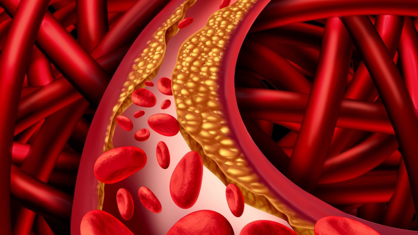 Global Vascular Grafts Market Overview And Prospects – includes Vascular Grafts Market Trends
