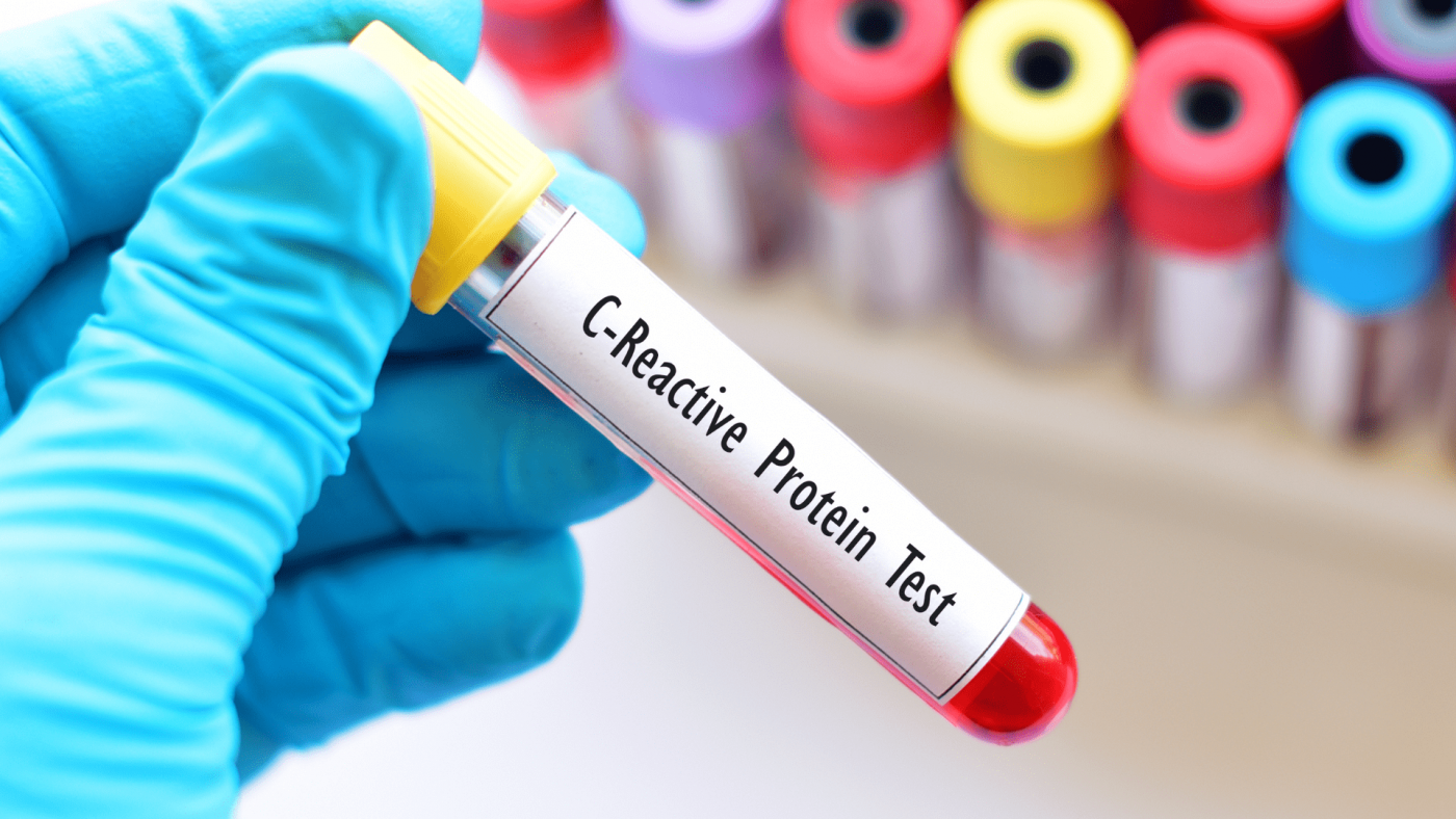 Global C-Reactive Protein Testing Market Outlook, Opportunities And Strategies – Includes C-Reactive Protein Testing Market Analysis