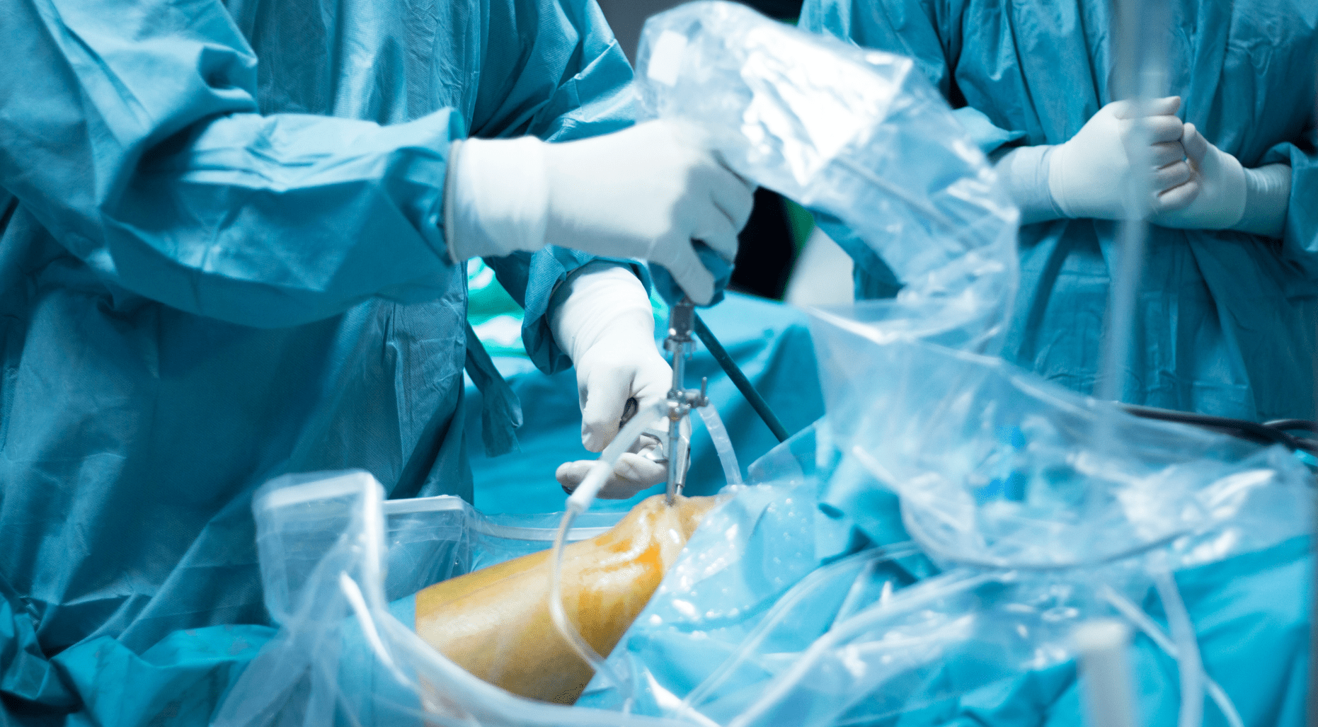 Global Orthopedic Regenerative Surgical Products Market Size, Forecasts, And Opportunities – Includes Orthopedic Regenerative Surgical Products Market Share