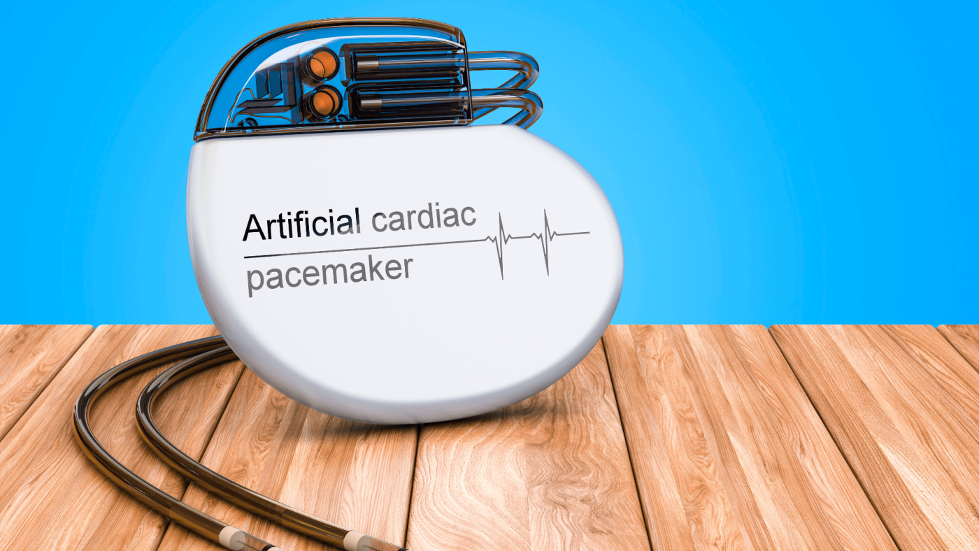 Global Pacemakers Market Outlook, Opportunities And Strategies – Includes Pacemakers Market Trends