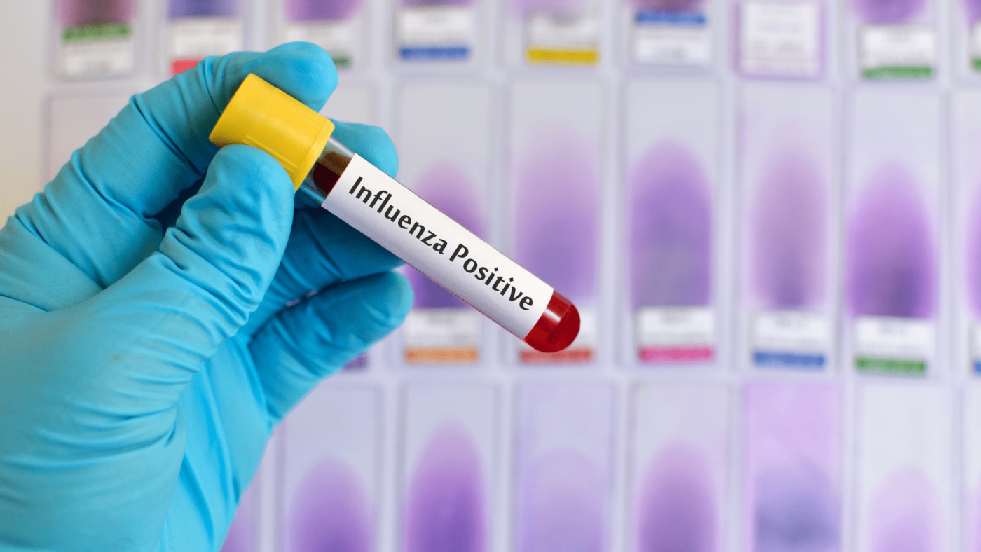 Best Prospects in the Influenza Diagnostics Market and Strategies for Growth – Includes Influenza Diagnostics Market Size