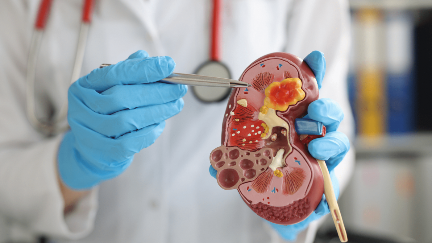 Kidney Cancer Drugs Market Growth Analysis And Indications – Includes Kidney Cancer Drugs Market Report