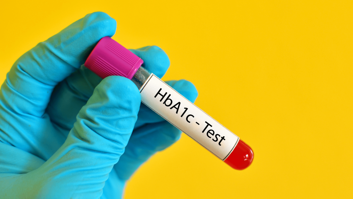 Global POC Hba1c Testing Market Size, Forecasts, And Opportunities – Includes POC Hba1c Testing Market Research